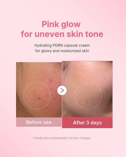 Pink Collagen Capsule Cream – GlowNéa